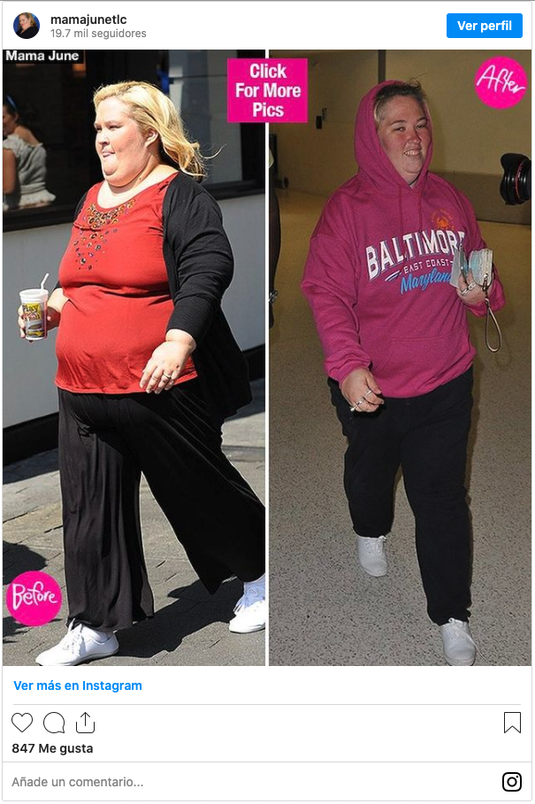 Is Mama June Wearing a Fat Suit? The 'From Not to Hot' Star Sets the Record  Straight